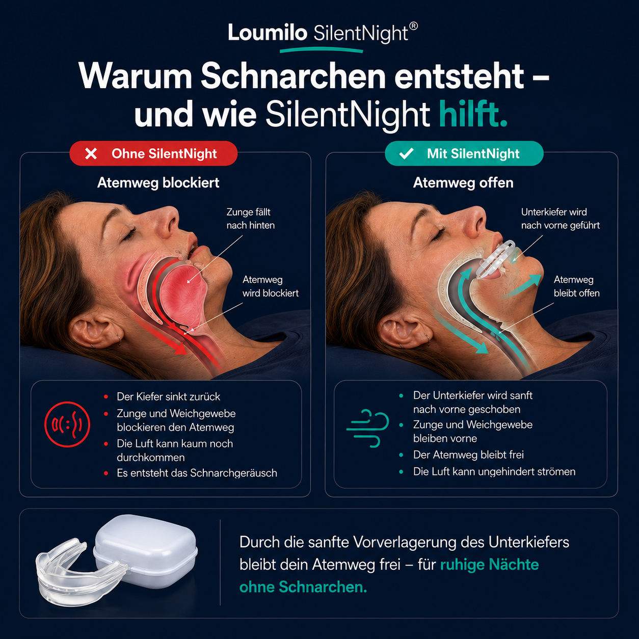 Loumilo SilentNight™ Für Frauen